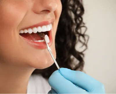 Image comparing dental veneers to teeth